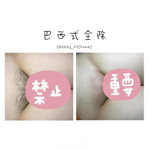 OkkkayChumaO彰化熱蠟除毛 - 