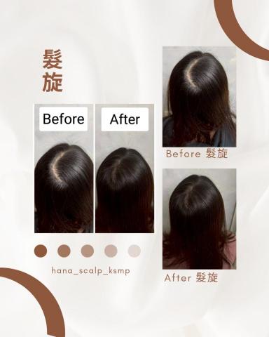 花紋 hana_scalp_ksmp - 哪怕是背影 依然好看 髮旋填補