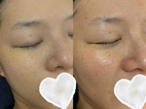 睫舞眉魔幻美學 - 美白課程