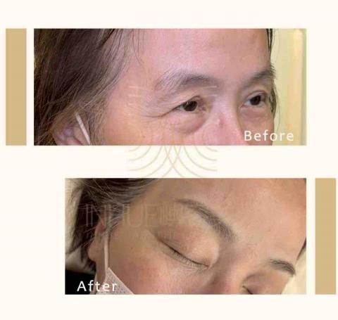 INHUE嶼容美學 - ✅機器霧眉

以臉型比例與原生眉條件為判斷基礎，不追求做滿或顏色明顯，而是讓眉毛回到適合整張臉的位置。適合喜歡自然、耐看、不想被看出來做過的人。