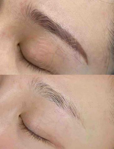 INHUE嶼容美學 - ✅ 無創除色（非破壞式）
並非急著清除眉毛，而是調整顏色位置，降低對後續設計的干擾。適合眉型尚可，但顏色過重或影響比例判斷者。