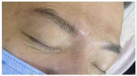 INHUE嶼容美學 - ✅機器野生眉

線條並非為了補滿，而是依照原生眉方向與骨架結構補足支撐。適合原生眉條件尚可，但希望調整方向與立體感者。