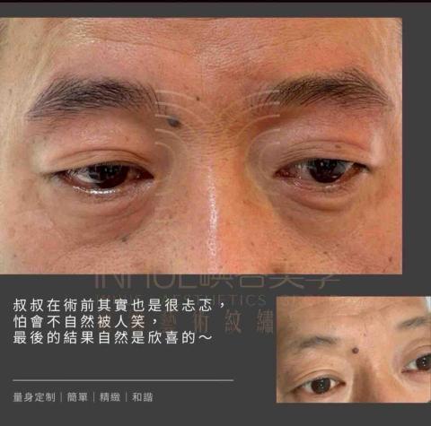 INHUE嶼容美學 - ✅機器野生眉

線條並非為了補滿，而是依照原生眉方向與骨架結構補足支撐。適合原生眉條件尚可，但希望調整方向與立體感者。