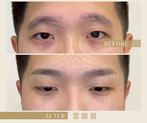 INHUE嶼容美學 - ✅機器霧眉

以臉型比例與原生眉條件為判斷基礎，不追求做滿或顏色明顯，而是讓眉毛回到適合整張臉的位置。適合喜歡自然、耐看、不想被看出來做過的人。