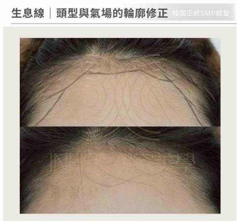 INHUE嶼容美學 - ✅韓國SMP紋髮

處理的不是頭髮本身，而是頭型比例、方向與密度節奏。操作前會依原生密度、光線與頭型評估，讓輪廓自然站得住。適合在意自然度、不希望一眼就被看出來做過的人。