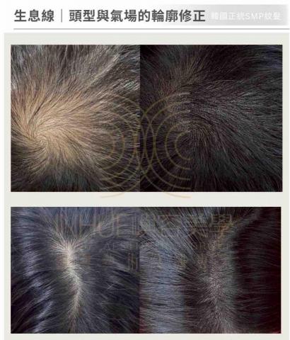 INHUE嶼容美學 - ✅韓國SMP紋髮

處理的不是頭髮本身，而是頭型比例、方向與密度節奏。操作前會依原生密度、光線與頭型評估，讓輪廓自然站得住。適合在意自然度、不希望一眼就被看出來做過的人。