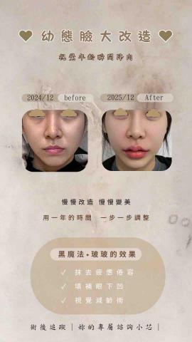 芯研美學ㅣ醫美諮詢顧問小芯 - 