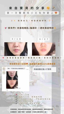 芯研美學ㅣ醫美諮詢顧問小芯 - 