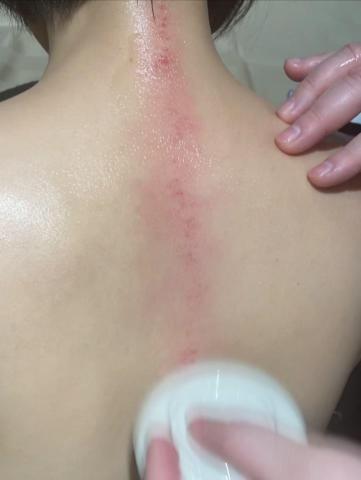 逸級撥筋/科學刮痧 - 科學刮痧-督脈