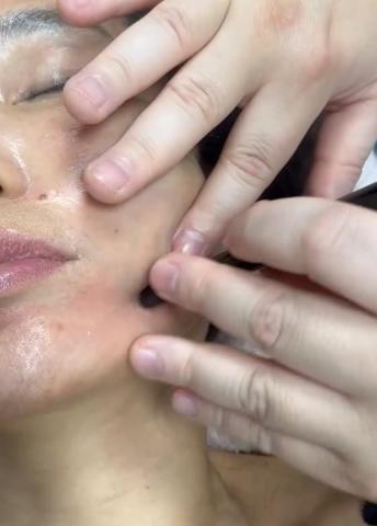 逸級撥筋/科學刮痧 - 小臉撥筋