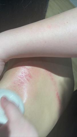 逸級撥筋/科學刮痧 - 科學刮痧-肩頸