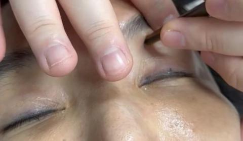 逸級撥筋/科學刮痧 - 眼週撥筋