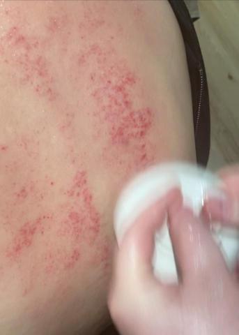 逸級撥筋/科學刮痧 - 科學刮痧-膀胱經