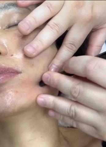 逸級行動Spa按摩 - 小臉撥筋