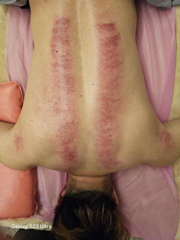 Yana wellness 健康美.復原所 - 