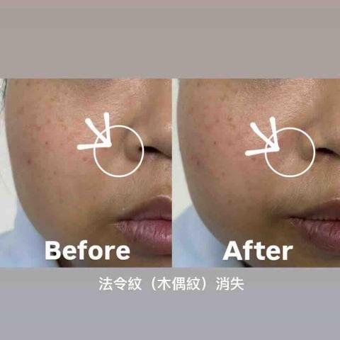 頂級養膚 x 醫美後修復 x 專業肌膚管理 - 