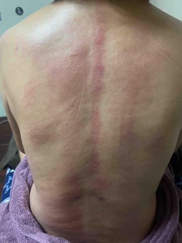 怡婷/耀朾精油溫罐&撥筋 - 