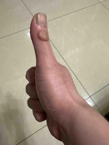 陳威翰 - 大拇指上的繭是從業多年的證明！