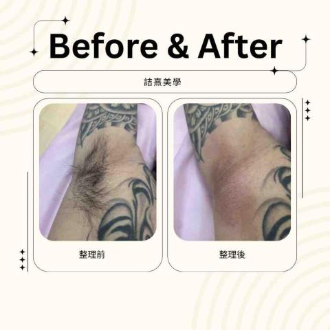 詰熹美學 -  熱蠟 腋下