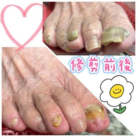 百企到府修剪指甲