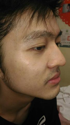 佳姿專業美容美體Spa中心 - 治療後