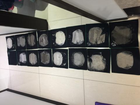 鄭文鐘 - 全戶深層除蟎後的黑布