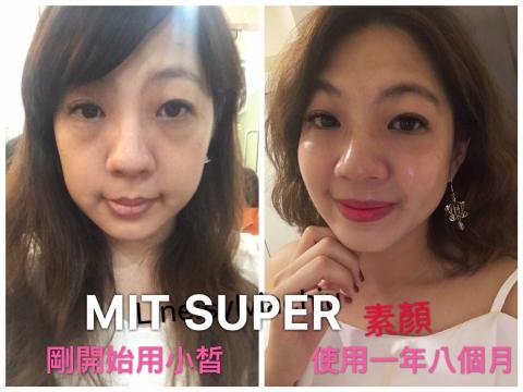 全美世界股份有限公司 - 臘黃肌