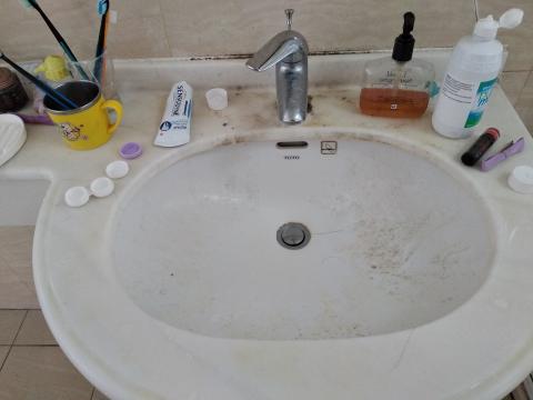 蕭小姐 - 清潔前