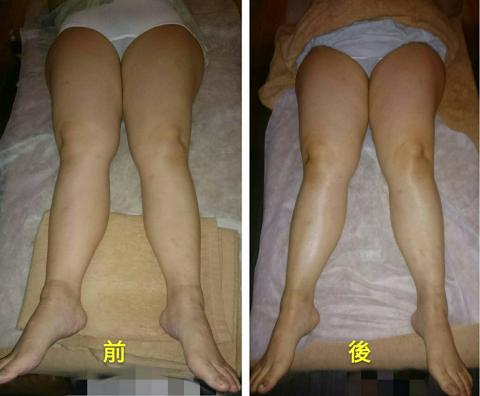 City Spa軟式瑜珈紓壓 - 體雕大腿正面
塑形緊實
消水腫 City Spa軟式瑜珈紓壓 - 體雕大腿正面
塑形緊實
消水腫