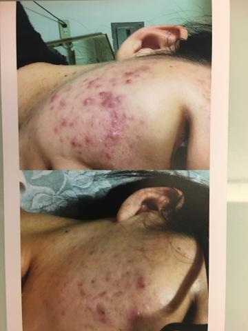 愛靡美學 - 皮膚調理