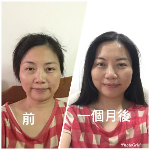 Dream place  - 自體荷蘭蒙調理