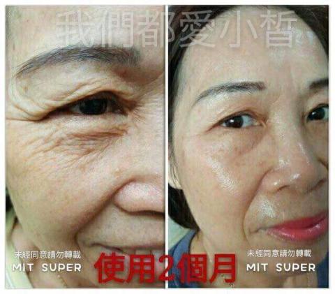 全美世界股份有限公司 - 老化肌