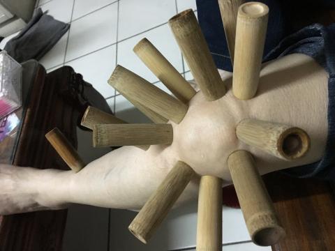 犀通堂傳統理療 - 膝關節藥罐處置