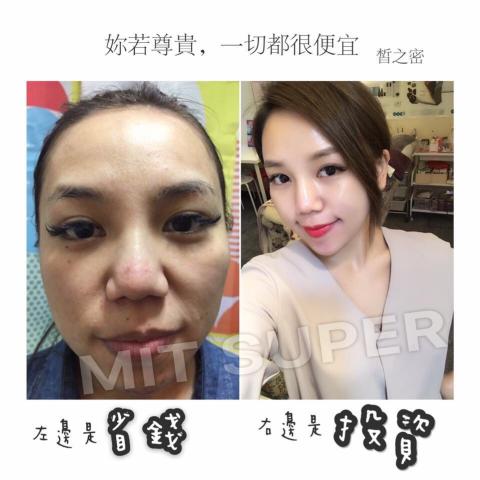 全美世界股份有限公司 - 暗沉肌