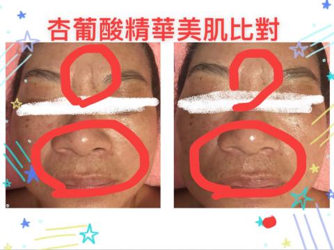 Rapha美容美體spa - 