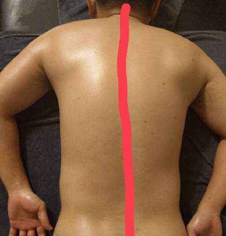 曦 spa - 左邊疏通後 右邊疏通前