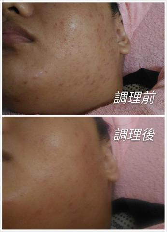 嬅婇美容經絡 - 臉部護膚