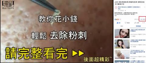 蕭筑文 - 粉刺夾商品介紹及試用QR Code影片 
FB觀看次數14萬