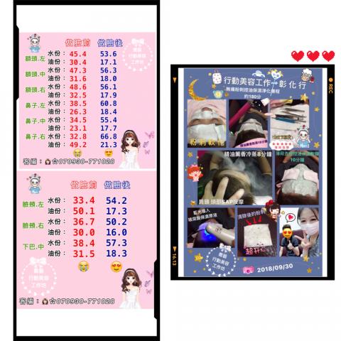 喬藝美容工作坊 - •無痛粉刺淨化控油抗痘保濕療程/約180分。
•做臉前後的水份、油份。