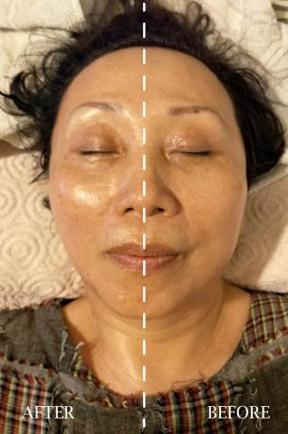 新店SPA深層按摩 - 電拿適用者條件如下:
1.須滿20歲以上
2.臉部鬆弛有法令紋佳
3.膚色黯沉面黃佳
4.不能是嚴重痘痘肌
5.有高低肩佳
6.有習慣按摩吃重力者
7.肩頸痠痛需舒緩者