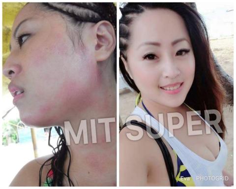 全美世界股份有限公司 - 敏感肌