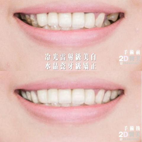 2D醫美-陳醫師 -  2D醫美-陳醫師 -