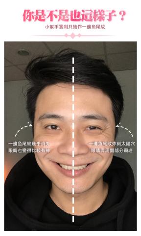 綻蓉美學．隱形液態微雕 - 抗皺技術：魚尾紋