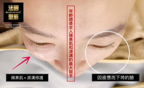 綻蓉美學．隱形液態微雕 - 修護技術：淚溝填補