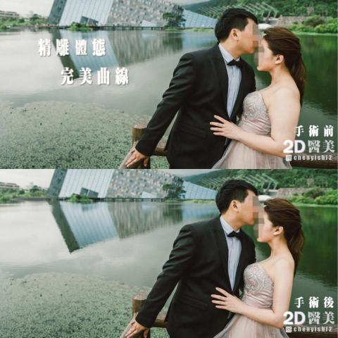 2D醫美-陳醫師 -  2D醫美-陳醫師 -