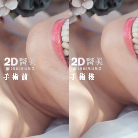 2D醫美-陳醫師 -  2D醫美-陳醫師 -