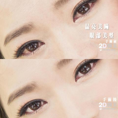 2D醫美-陳醫師 -  2D醫美-陳醫師 -