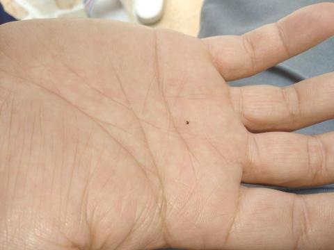 威喜實業除蟲有限公司 - 小黑蚊